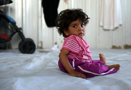 生まれつき背骨と左足の骨がゆがんでいるハサン・ゼイナブちゃん＝ヨルダン・ザルカ県のアズラック難民キャンプで、久保玲撮影
