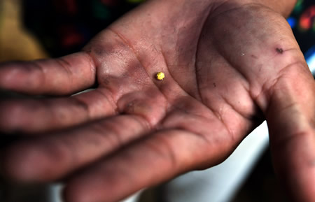水銀と金の合金をあぶって残った一粒の金を手のひらに載せる＝フィリピン・カマリネスノルテ州ホセパガニバンで
