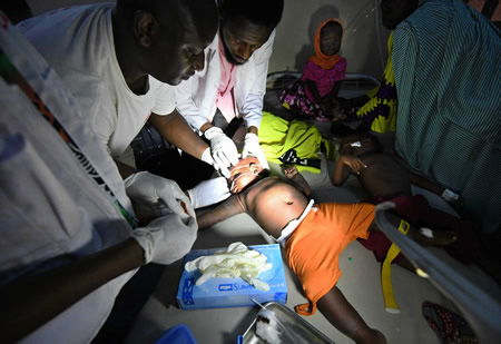 マラリアの治療のため、ぐったりする子どもの頭に点滴用の針を刺す医師たち