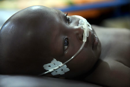 マラリアに感染し、治療を受けるアイシャ・モハメッドさん（２５）の息子・ムスタファちゃん（３）